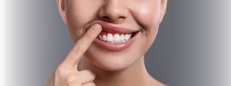 National Gum Care Month